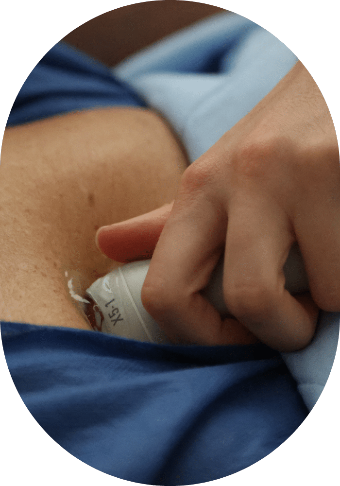 Écho-cardiographie transthoracique